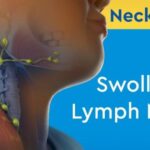 Swollen Lymph Nodes During Period