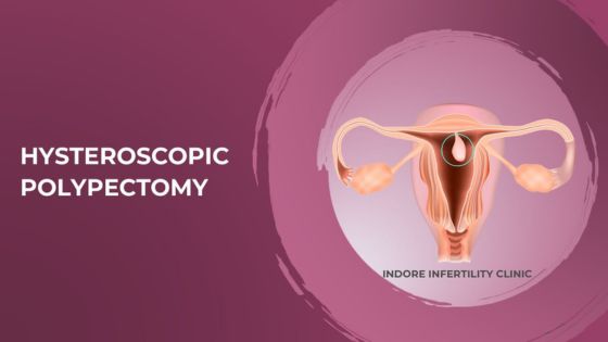 Pros and Cons of Ablation vs Hysterectomy