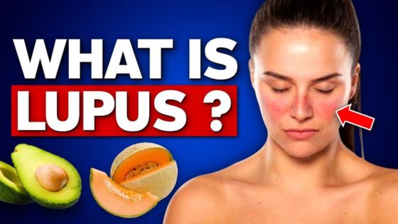 Can Lupus Affect Your Liver